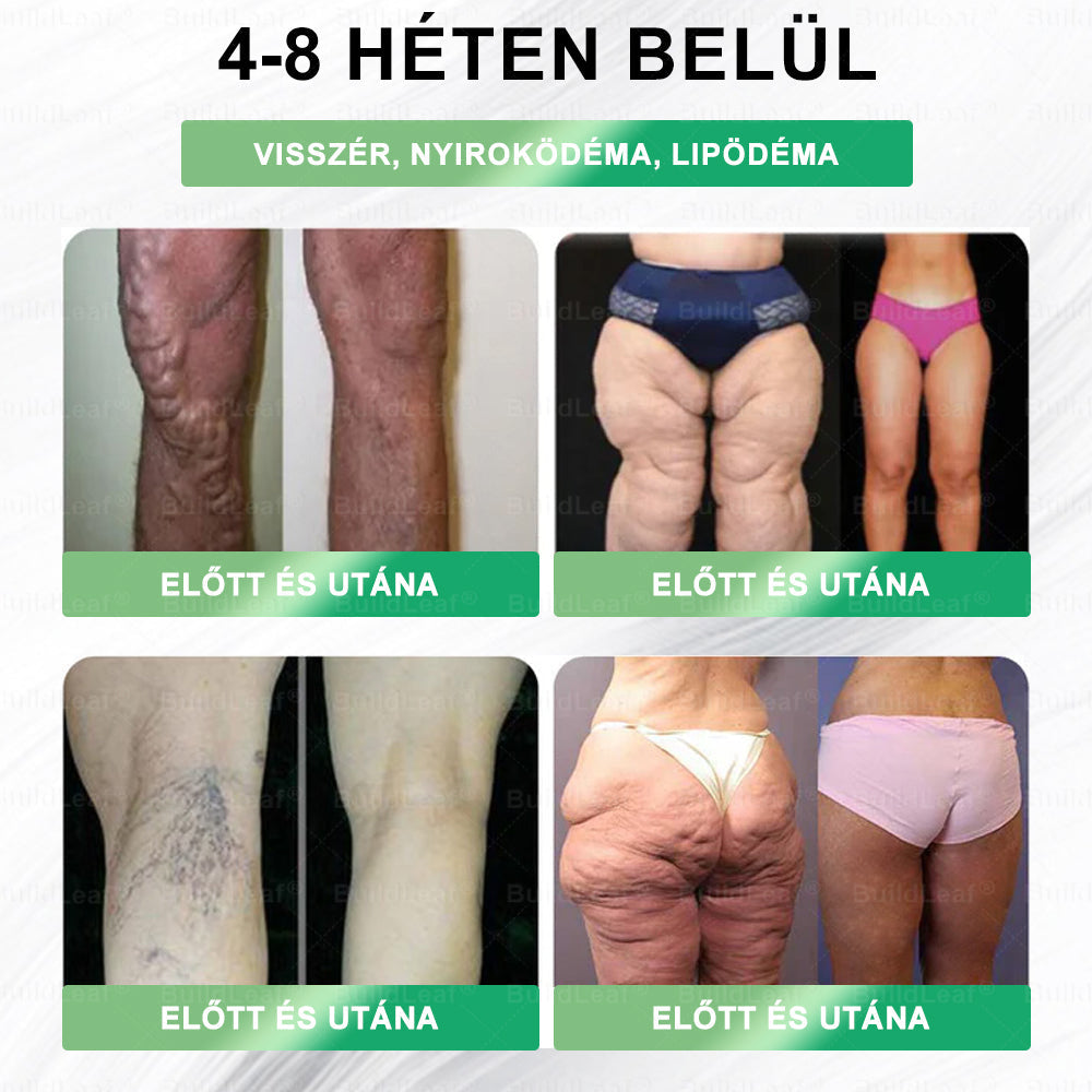 đżMĂĄr csak 5 doboz maradt! Extra 70%-os kedvezmĂ©nyt kĂnĂĄlunk! Maradj egĂ©szsĂ©ges! Ha most kihagyod, csak jövĆre lesz Ășjra lehetĆsĂ©ged.
