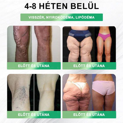 🌿Már csak 5 doboz maradt! Extra 70%-os kedvezményt kínálunk! Maradj egészséges! Ha most kihagyod, csak jövőre lesz újra lehetőséged.